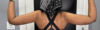 Arm Lift case #5018
